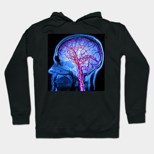 Vascular system of the brain, artwork (C024/6525) Hoodie